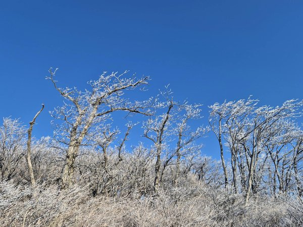 Implants capillaires à lyon : découvrez les techniques fue et fut